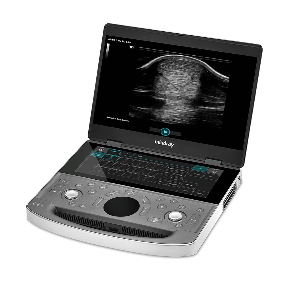 [A3045500202] Vetus EQ promotional package + 2 transducers of your choice, Linear Rectal (6LE5Vs - 304518), Linear T-shaped (L13-3Ns - 305092) or Abdominal Convex (C5-1s - 304551) + 12x ultrasound gel (Transducer linear T-shaped, Transducer linear rectal)