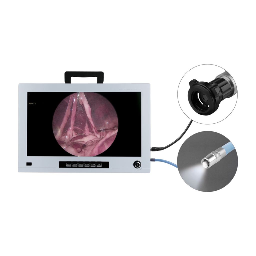 Monitor endoskopi Eickview 22", Full HD med integreret CCD kamera og lyskilde