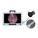 Monitor endoskopi Eickview 22", Full HD med integreret CCD kamera og lyskilde
