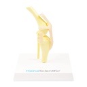 Tipo de modelo Osteo: Rodilla (modelo nuevo)