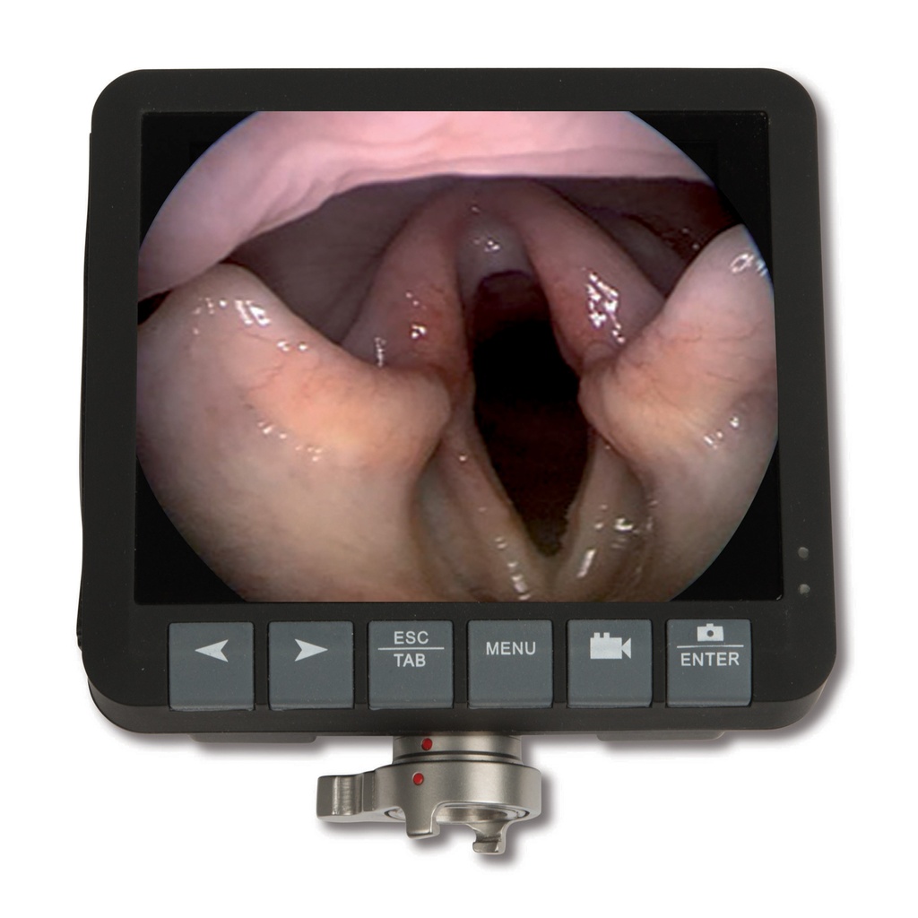 [30601004] Moniteur de rechange EickView de 3,5" pour Eickview 60, 70, 100E, 150E
