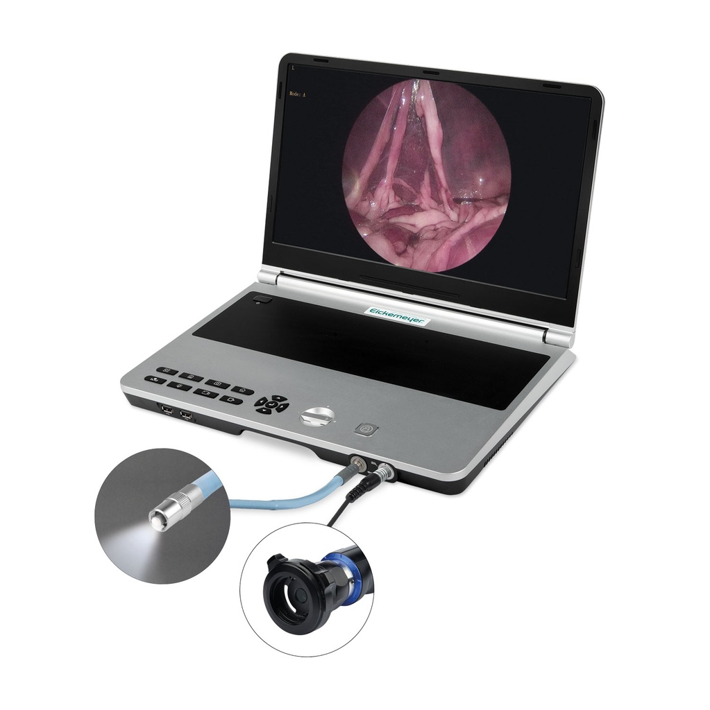 [306106] EickView 4-en-1 Sistema de Endoscopia Compacto