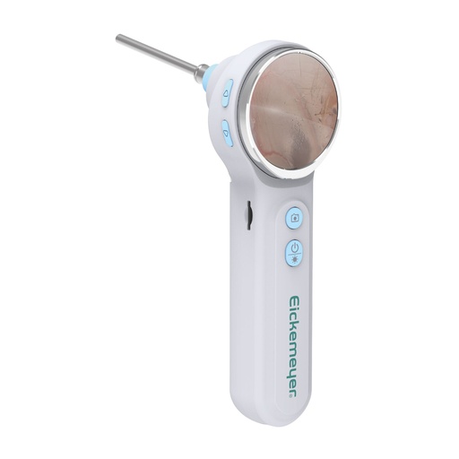 [300130] EickView OTO - Vidéo-otoscope digital
